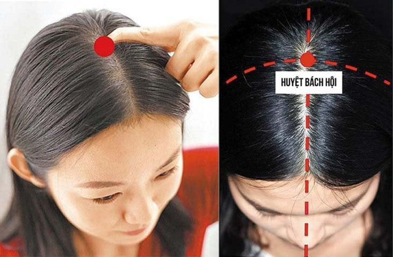 Vị trí huyệt Bách Hội nằm trên đỉnh đầu