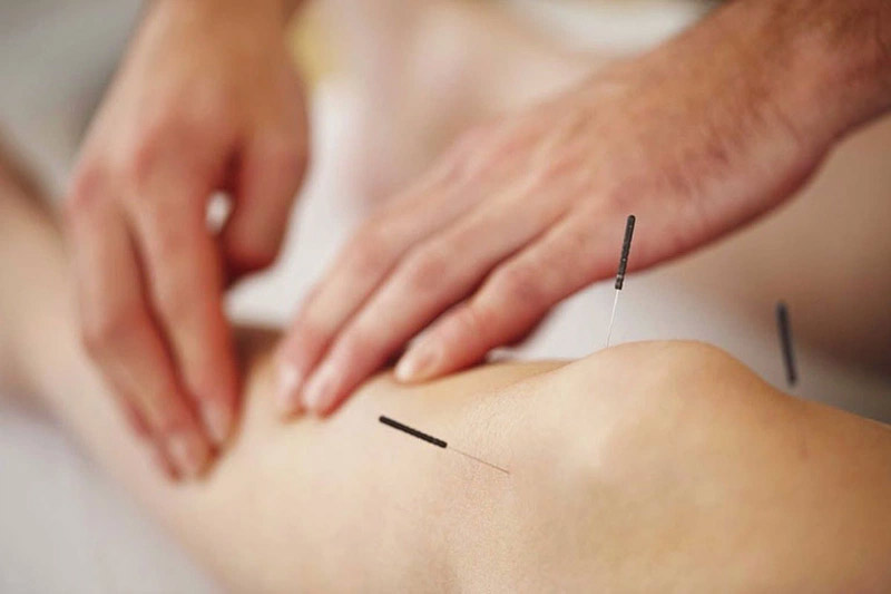 Thực hiện châm cứu huyệt Huyết Hải