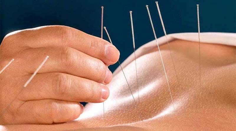 Cách châm cứu huyệt Cách Du là gì?