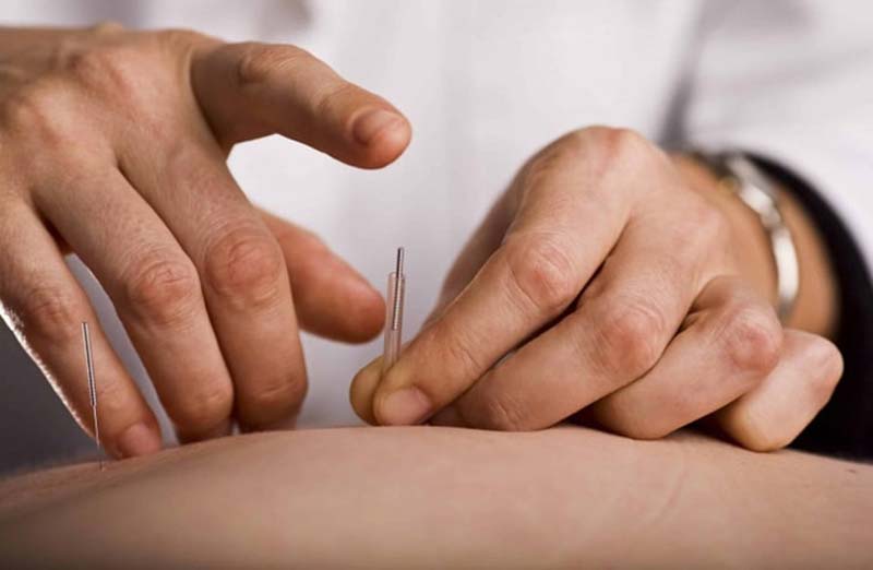 Châm cứu kích thích sâu vào huyệt Đại Hách