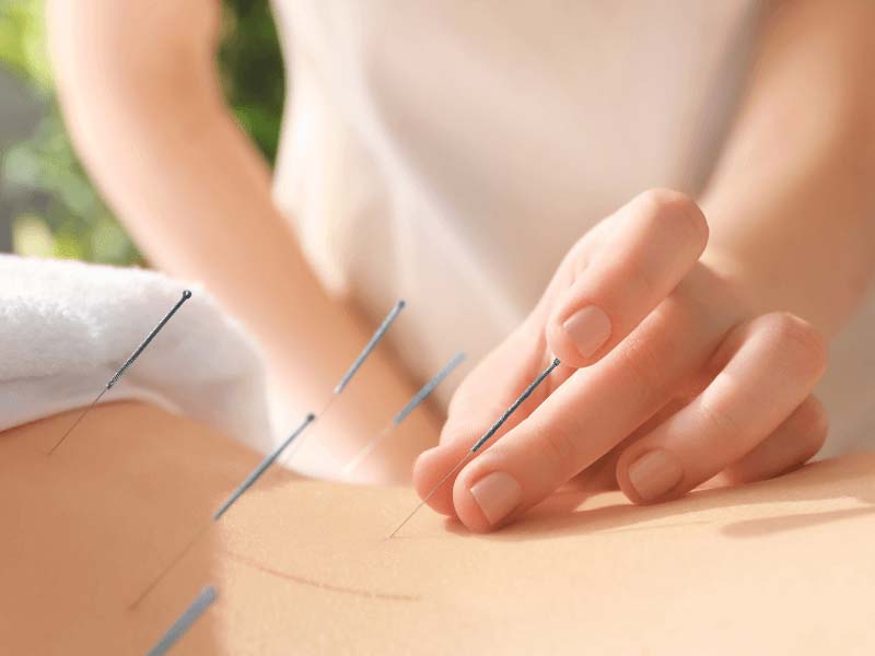 Châm cứu huyệt Yêu Nhãn hiệu quả với các bệnh lý mãn tính
