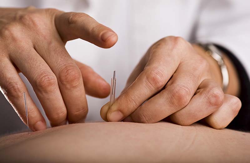 Châm cứu huyệt Cự Khuyết điều trị các bệnh lý mãn tính