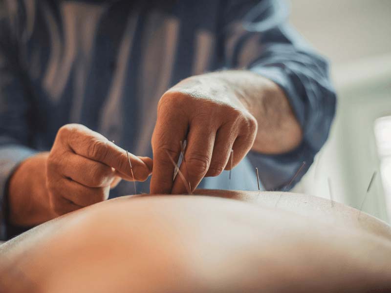 Châm cứu huyệt Đại Trường Du kích thích sâu đem lại tác dụng lớn