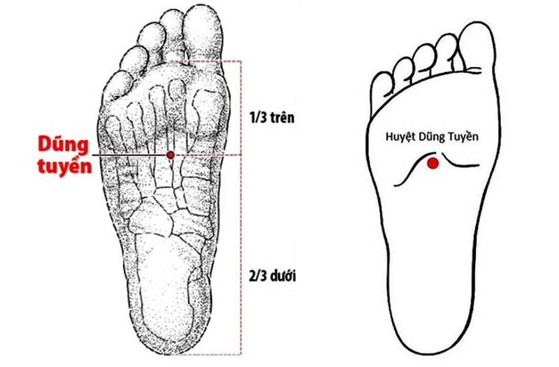 Vị trí huyệt Dũng Tuyền nằm dưới lòng bàn chân