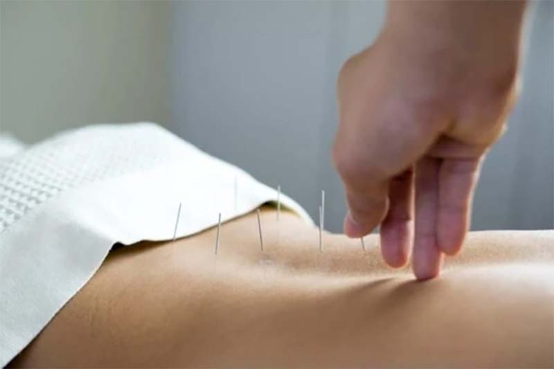 Châm cứu huyệt Thận Du là kỹ thuật nâng cao trong Đông y