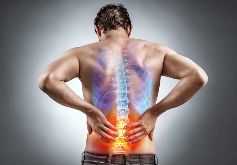 Các tổn thương cơ, xương, cột sống là nguyên nhân phổ biến gây ra tình trạng đau thắt lưng