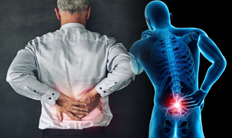Stress do làm việc quá sức cũng có thể gây ra các cơn đau lưng dữ dội