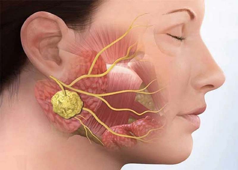 Kích thích huyệt giúp cải thiện tình trạng viêm tuyến nước bọt
