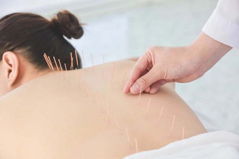 Châm cứu huyệt Tỳ Du ngay sau khi đã xác định vị trí chính xác