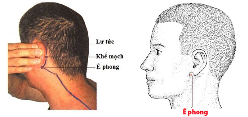 Vị trí huyệt Ế Phong