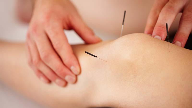 Kết hợp huyệt Tất Nhãn và các huyệt vùng đầu gối để tăng hiệu quả trị bệnh