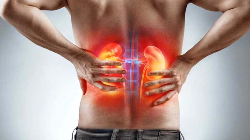 Bệnh lý sỏi thận cũng là nguyên nhân gây đau lưng phải ở nhiều người