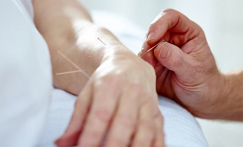 Cách châm cứu lên huyệt Dưỡng Lão