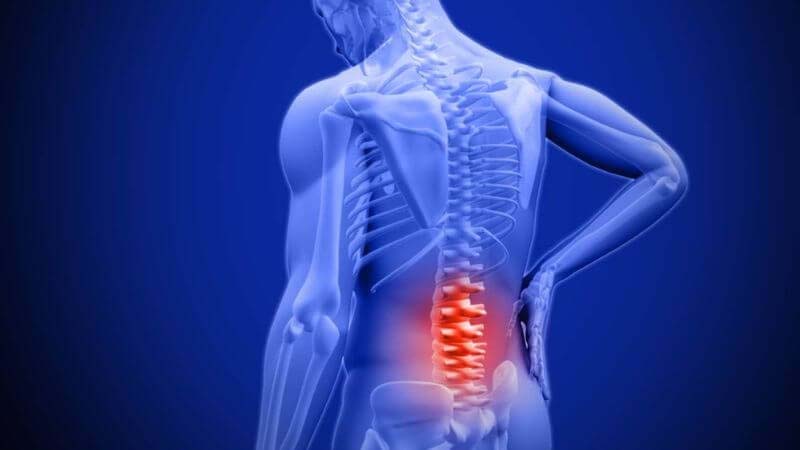 Các vị trí đau lưng nguy hiểm tại thắt lưng