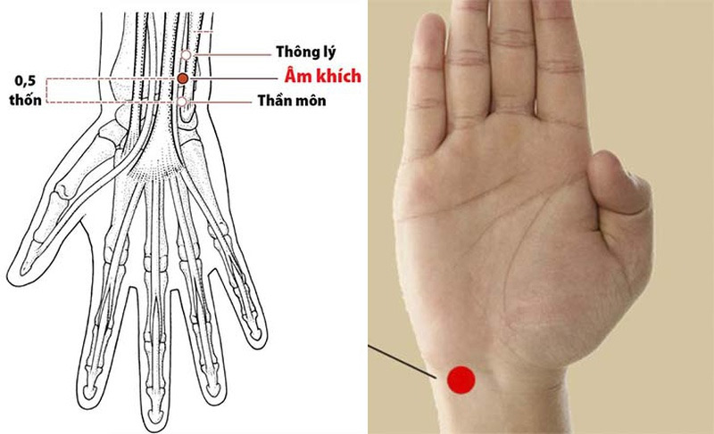 Vị trí huyệt Cánh Tay Thần Môn
