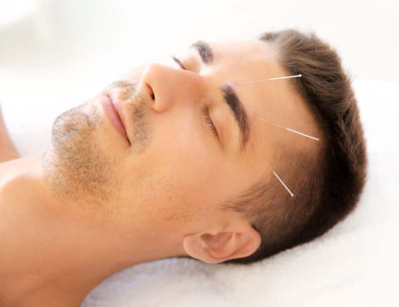 Châm cứu huyệt Toàn Trúc tại cơ sở y tế uy tín
