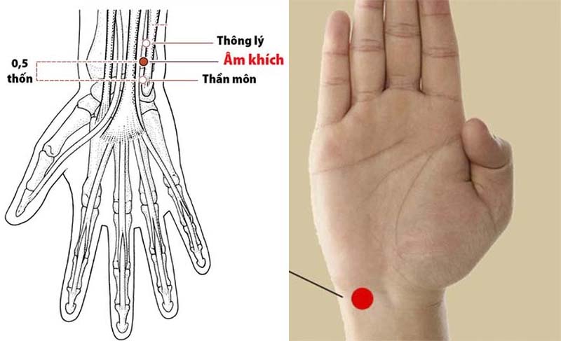 Hình ảnh huyệt Thần Môn nằm trên cổ tay không phải trên vành tai