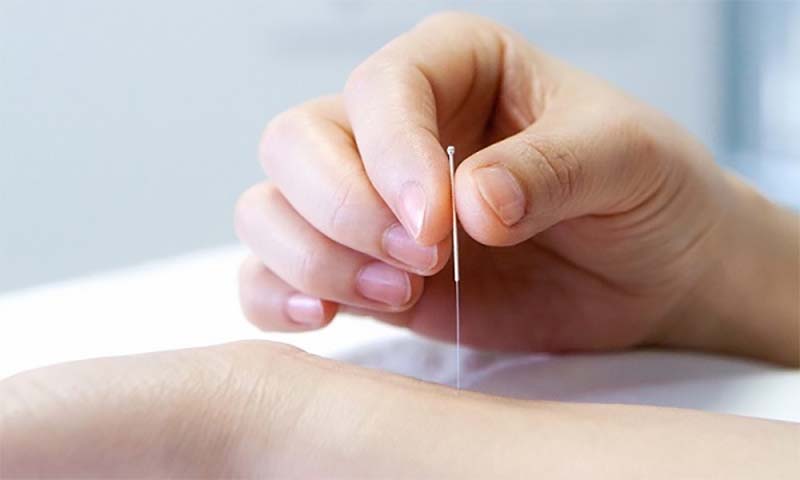 Xác định huyệt Thần Môn ở tay nào trước khi châm cứu