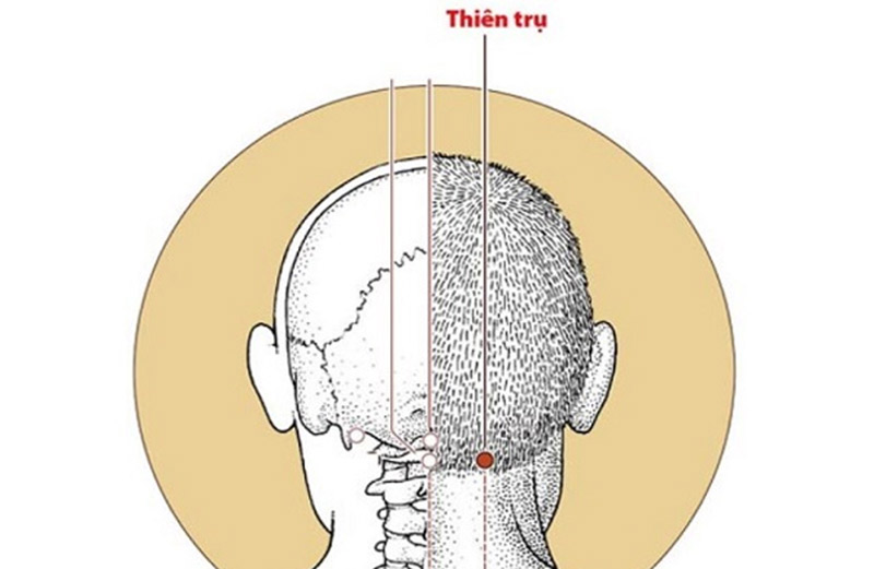 Thiên Trụ là một trong các huyệt cổ vai gáy được sử dụng nhiều nhất