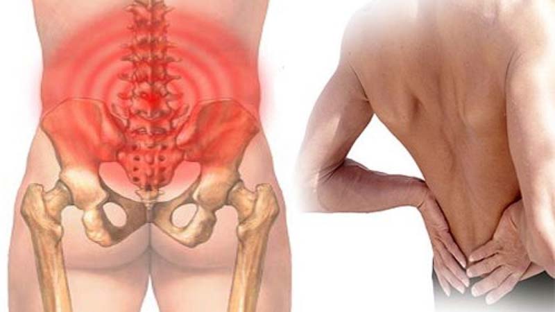 Nhĩ châm - giải pháp hữu hiệu giảm các cơn đau lưng dưới