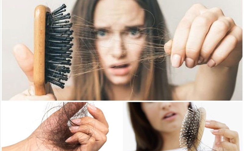 Có nhiều nguyên nhân gây ra rụng tóc