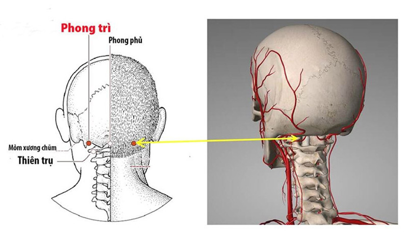 Xác định vị trí huyệt Phong Trì