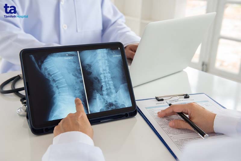 Chụp X-quang để tìm hiểu chính xác nguyên nhân gây bệnh