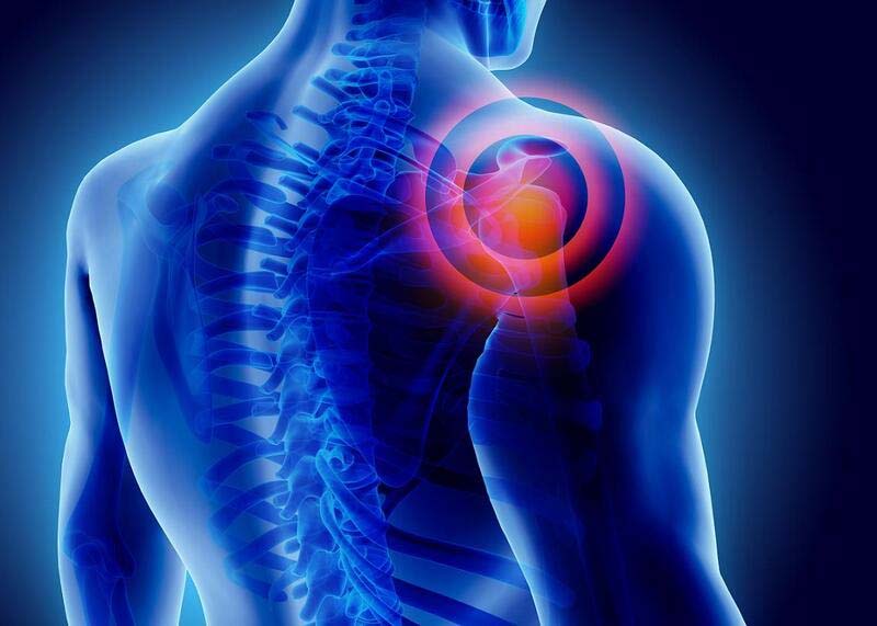 Tác dụng huyệt Kiên Ngung hiệu quả với các bệnh lý vùng vai, cánh tay, cổ,...