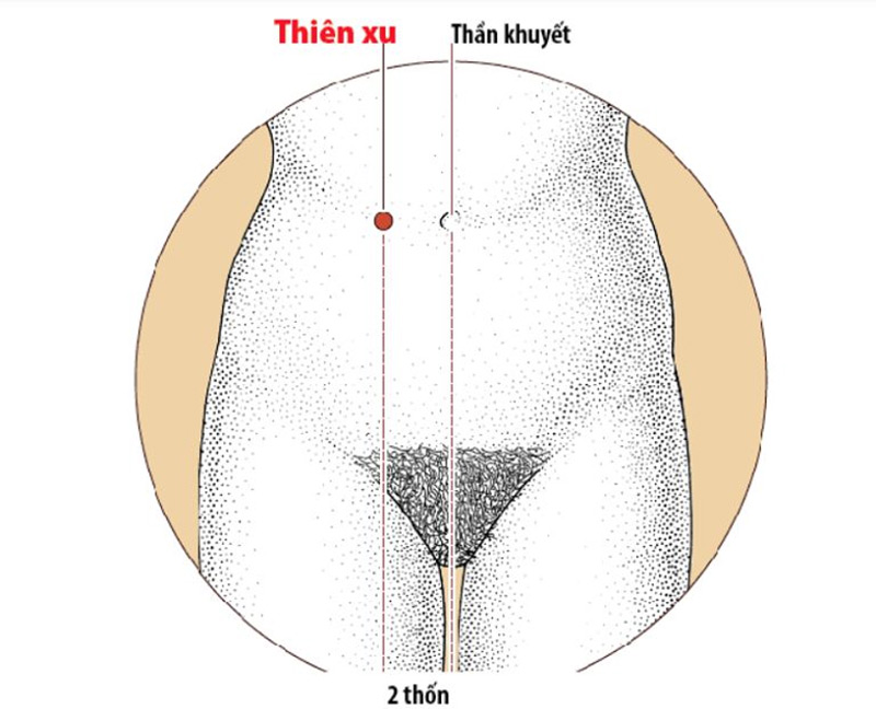 Ứng dụng bấm huyệt giảm đầy bụng Thiên Xu để giảm nhanh khó chịu