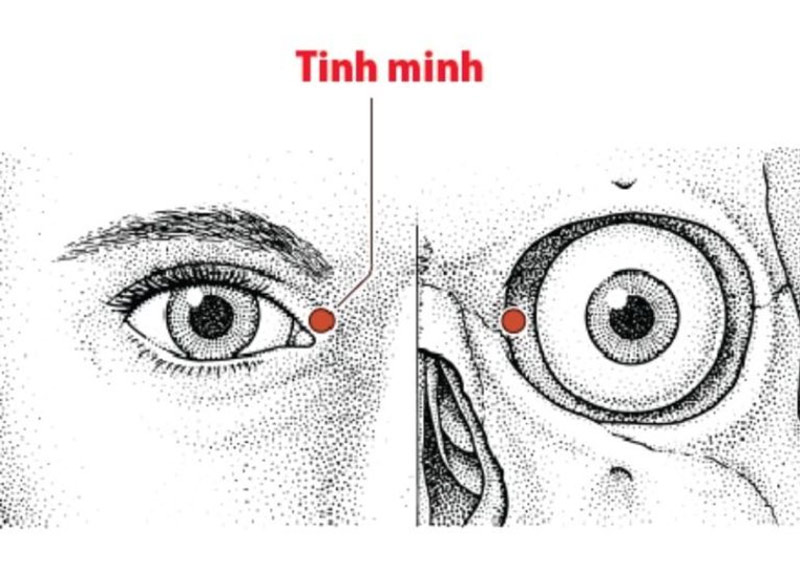Huyệt Tinh Minh - Một trong 7 huyệt làm sáng mắt tốt nhất