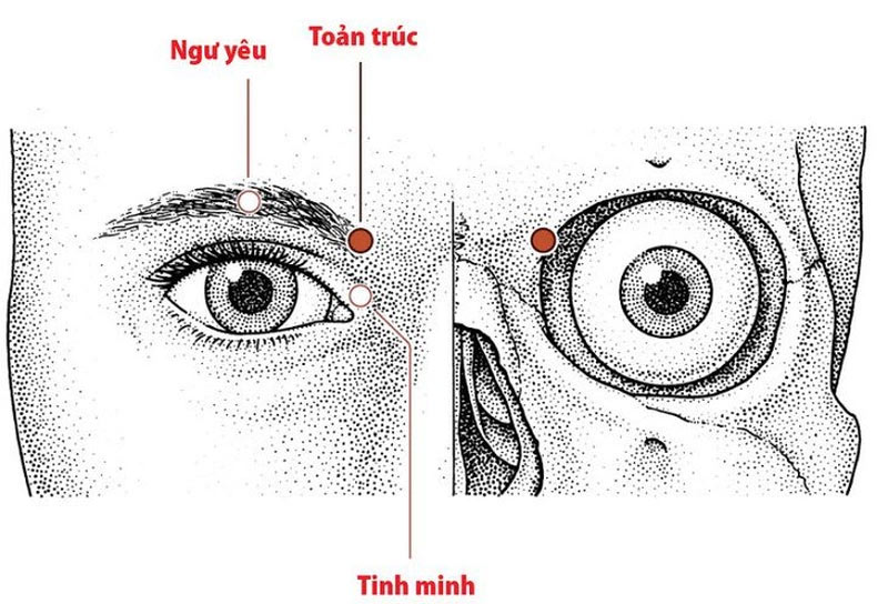 Vị trí huyệt Tình Minh