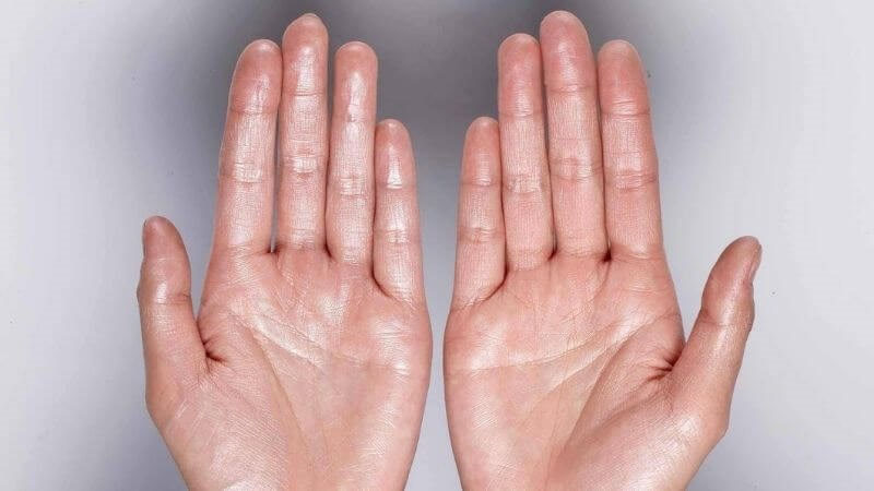 Huyệt giúp giảm tình trạng ra mồ hôi quá mức