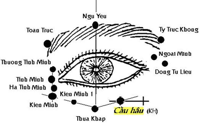 Vị trí huyệt Cần Hậu