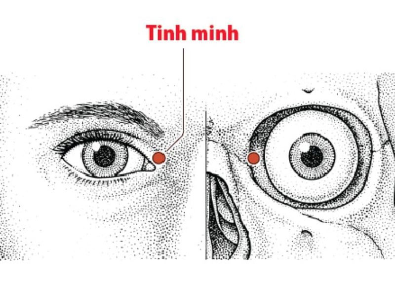 Huyệt Tình Minh - Một trong các huyệt đạo ở mắt tốt nhất