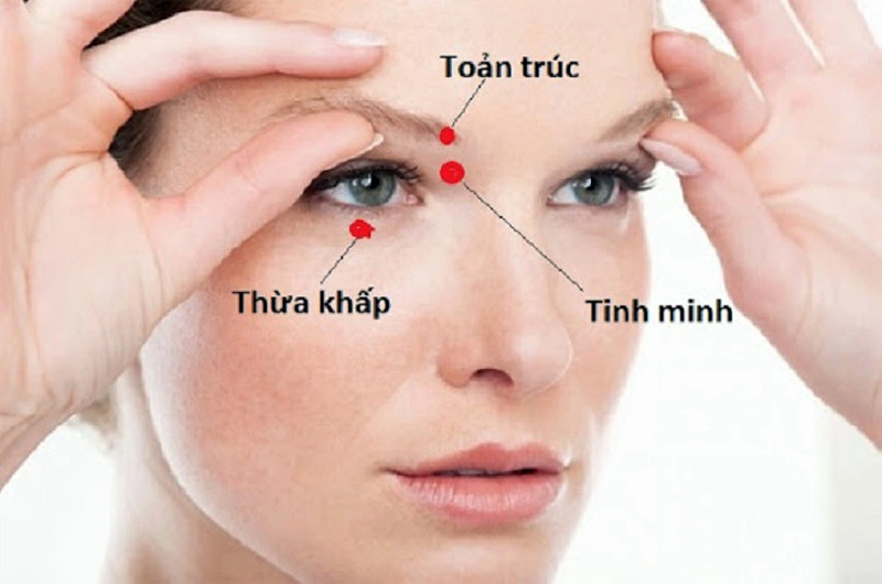 Vị trí huyệt Thừa Khấp trên vùng mắt