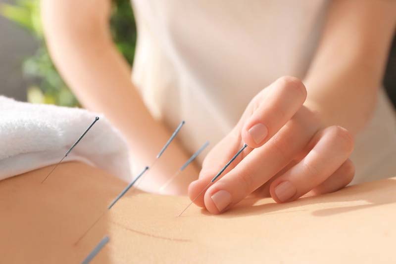 Châm cứu huyệt Thượng Quản chữa các bệnh lý mãn tính