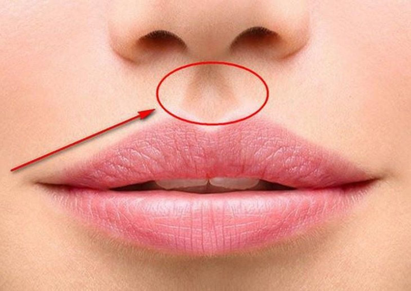 Huyệt đạo Nhân Trung: Vị trí, tác dụng và cách châm cứu, bấm huyệt