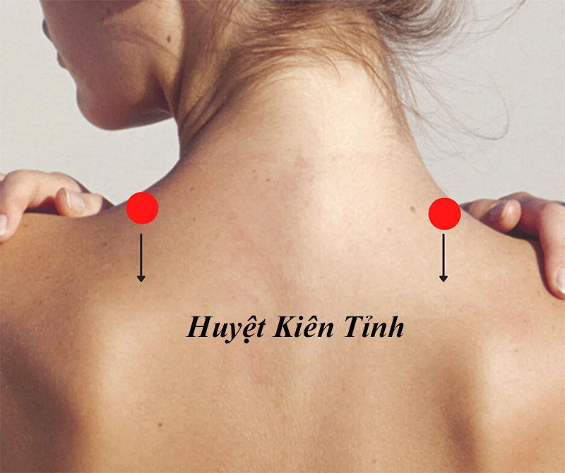 Huyệt Kiên Tỉnh: Vị trí, tác dụng và cách châm cứu, bấm huyệt