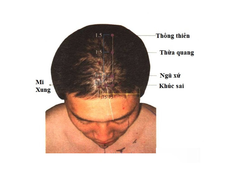 Huyệt Thừa Quang: Vị trí, tác dụng và cách tác động